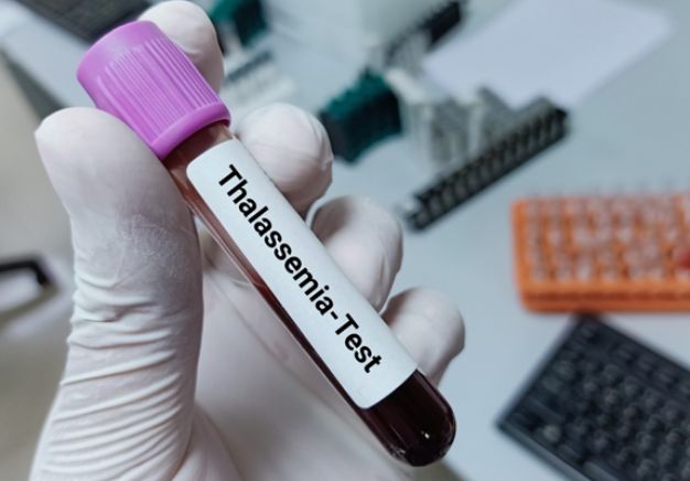 Before Saying “I Do”: The Importance of Thalassemia Screening